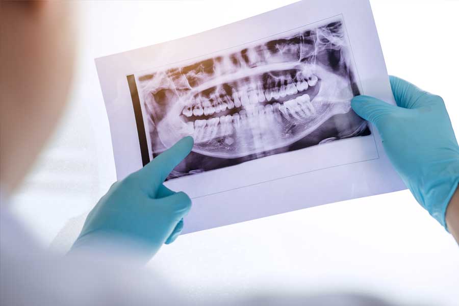 Dental professional reviewing panoramic X-ray for oral surgery diagnosis and treatment planning.